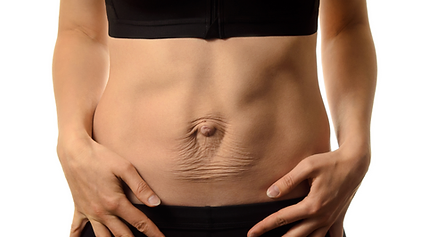 woman abdominals after birth